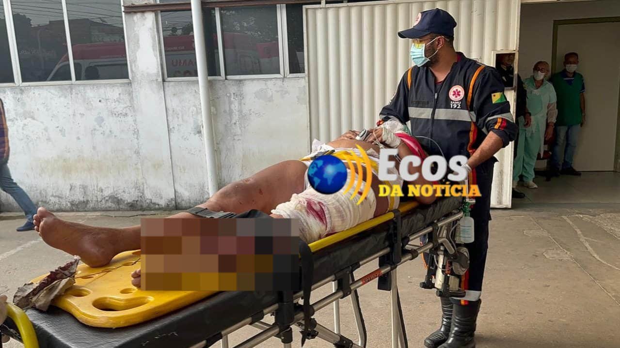 Grave acidente em Rodovia, deixa mulher com perna amputada em Rio Branco