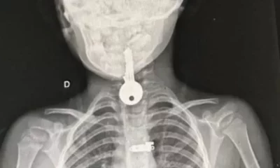 WhatsApp-Image-2023-11-07-at-03.32.04-jpeg WhatsApp-Image-2023-11-07-at-03.32.04-jpeg