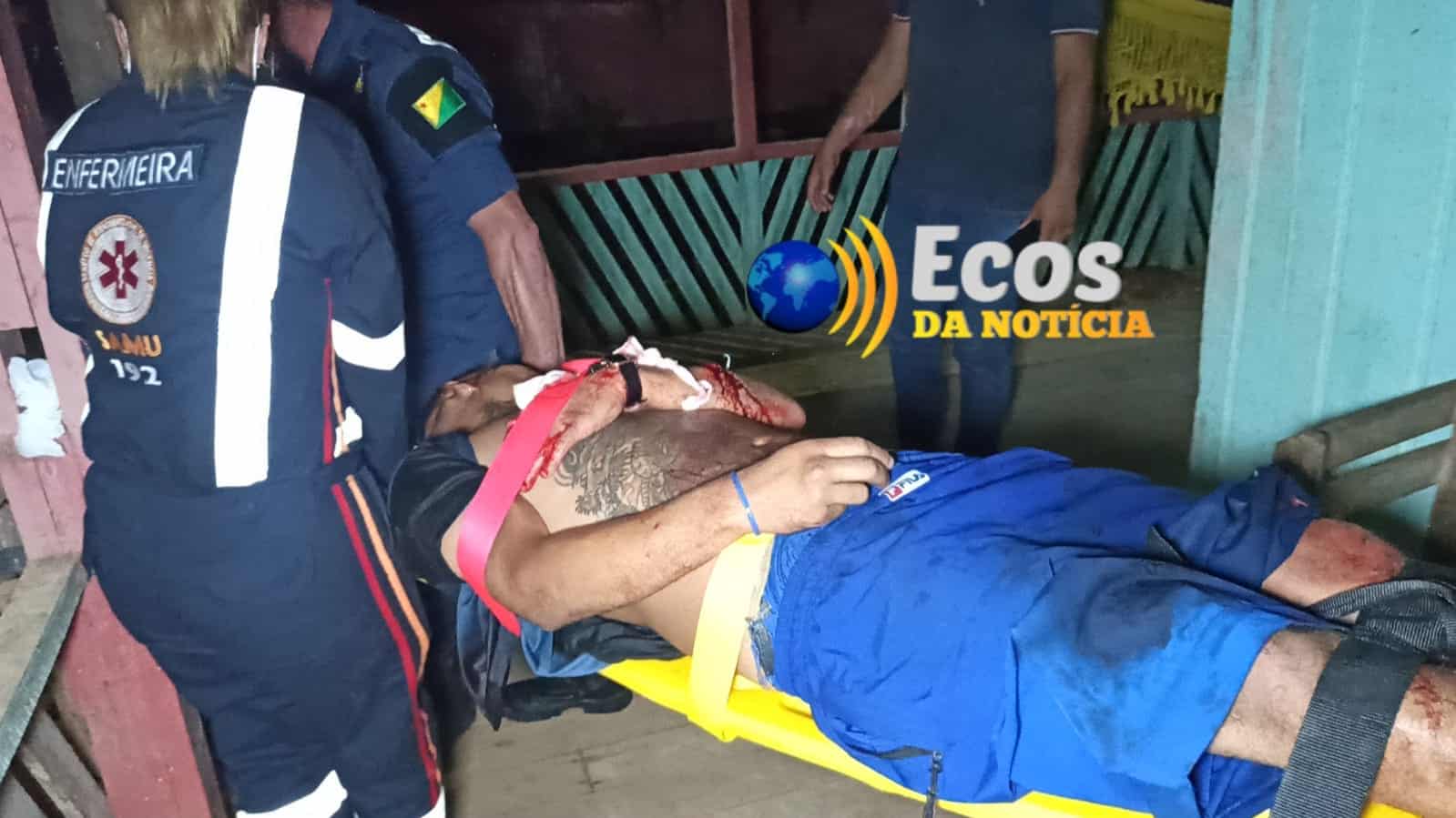 Homem é ferido a golpes de faca no bairro Volta Seca, na capital