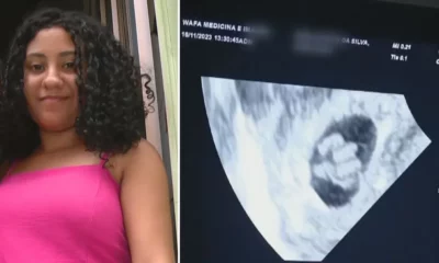 g1-quintuplos g1-quintuplos