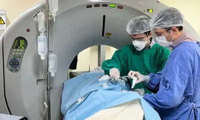 ablacao-por-micro-ondas-ascom-hgrs-1-