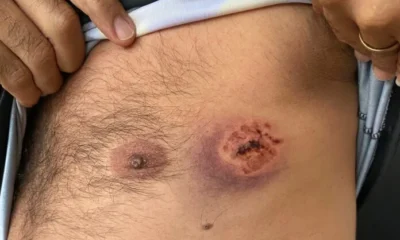 dentada-jpeg dentada-jpeg