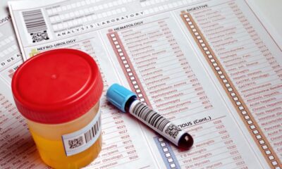 exames-toxicologicos-quando-e-necessario-que-o-funcionario-faca-810×540 exames-toxicologicos-quando-e-necessario-que-o-funcionario-faca-810x540