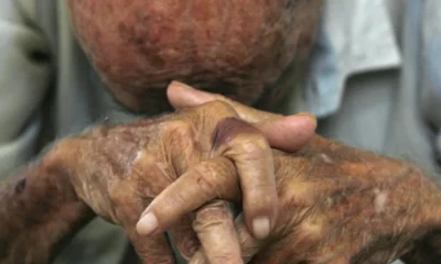 IDOSO-MAUS-TRATOS-1000x600