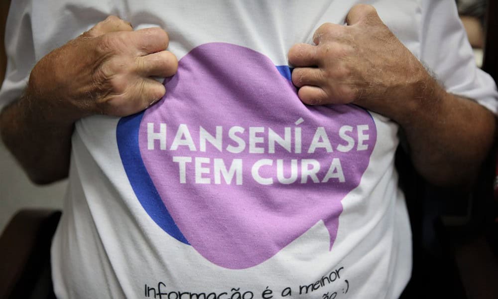 MPAC-Seminário-Hanseníase-Foto.-Odair-Leal-Secom-6-1200x802