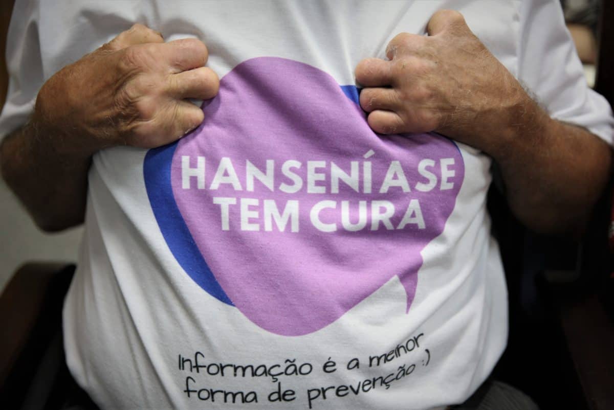 Secretaria de Saúde do Acre apoia campanha Janeiro Roxo, de prevenção à hanseníase