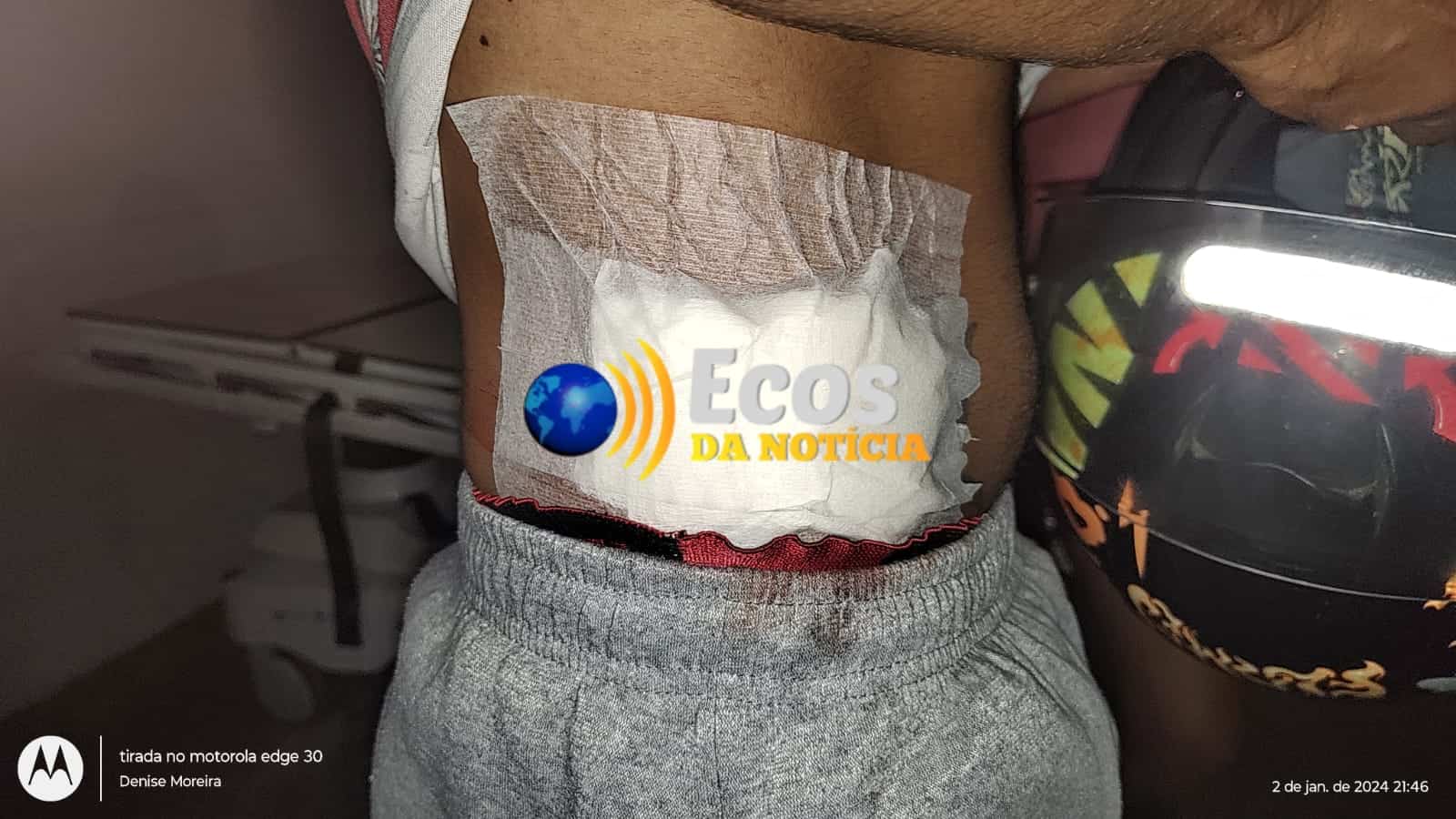 Motoboy de aplicativo reage à assalto e é baleado no bairro Canaã, em Rio Branco