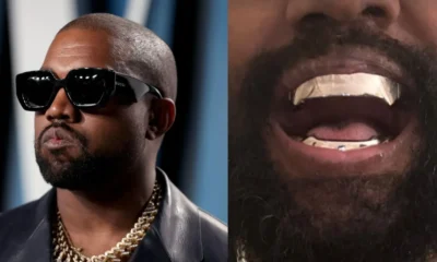 kanye-west-protese-titanio kanye-west-protese-titanio