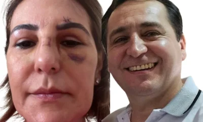 servidor-e-ex-exposa-jpg servidor-e-ex-exposa-jpg