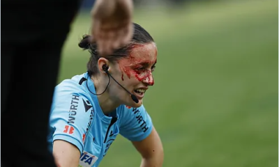 Bandeirinha-e-atingida-por-camera-em-jogo-da-LALIGA