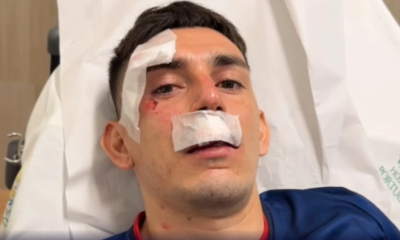 Gonzalo-Escobar-lateral-esquerdo-do-Fortaleza-levou-pancada-na-cabeca-e-passou-por-tomografia Gonzalo-Escobar-lateral-esquerdo-do-Fortaleza-levou-pancada-na-cabeca-e-passou-por-tomografia