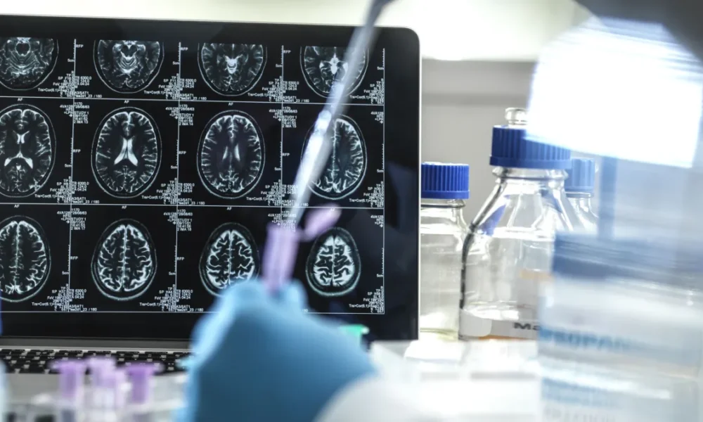 cerebro-laboratorio cerebro-laboratorio