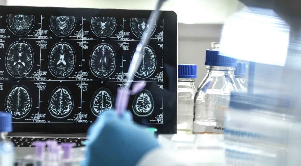 Casos de demência podem ser causados por doença no fígado, mostra estudo