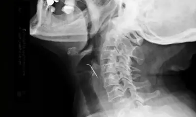 2024-03-27T143004Z_3_LOP114027032024RP1_RTRMADP_BASEIMAGE-960X540_PERU-NAIL