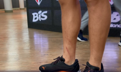 Pablo-Maia-exibe-arranhoes-na-perna Pablo-Maia-exibe-arranhoes-na-perna