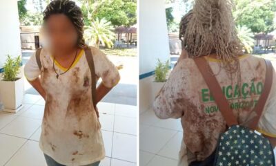 Menina, de 12 anos, foi agredida em escola municipal em Novo Horizonte (SP) — Foto: Arquivo pessoal