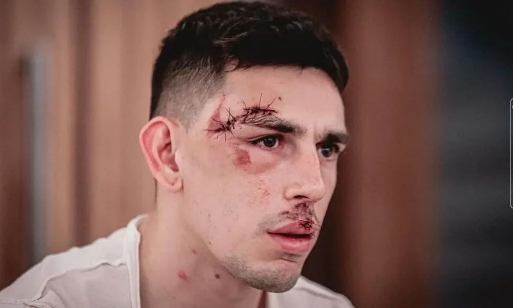 gonzalo-escobar-fortaleza-ataque-onibus-sport-1-e1708649844456 gonzalo-escobar-fortaleza-ataque-onibus-sport-1-e1708649844456