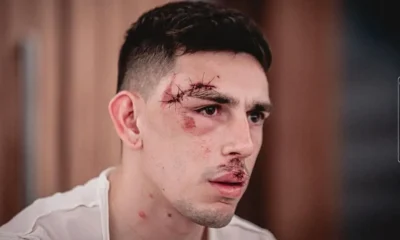 gonzalo-escobar-fortaleza-ataque-onibus-sport-1-e1708649844456 gonzalo-escobar-fortaleza-ataque-onibus-sport-1-e1708649844456