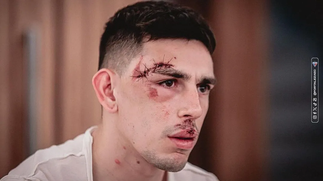 Sport é condenado com 8 jogos sem torcida por ataque ao ônibus do Fortaleza