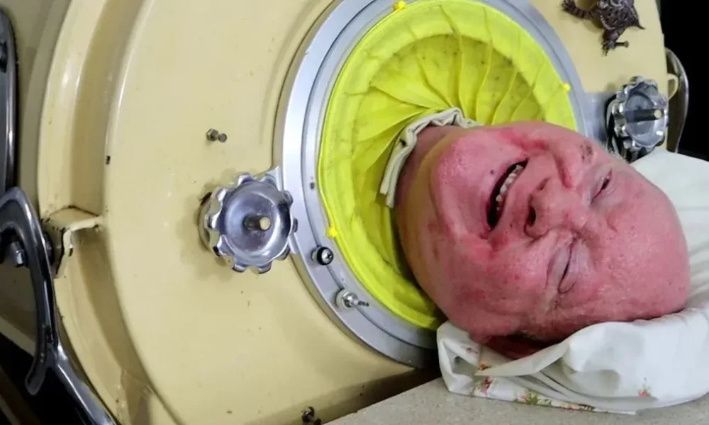 paul-alexander-pulmao-de-ferro-e1710335246371 paul-alexander-pulmao-de-ferro-e1710335246371