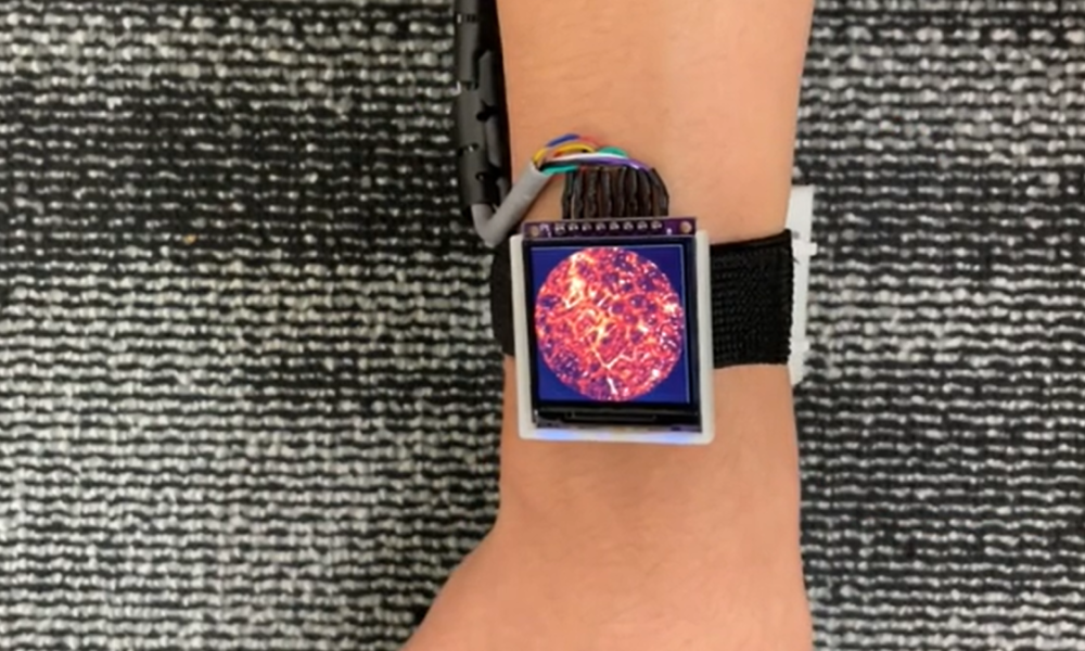 relogio-vasos-sanguineos relogio-vasos-sanguineos