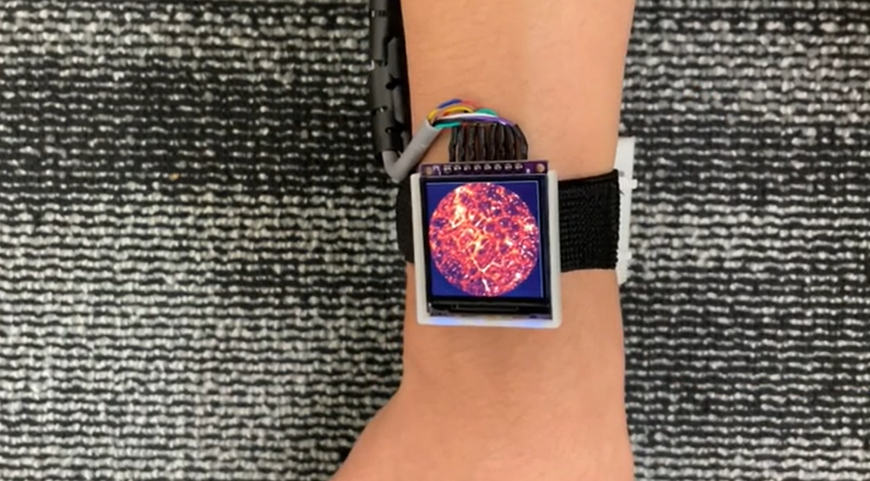 Relógio mostra interior das veias em tempo real e acelera diagnóstico de doenças
