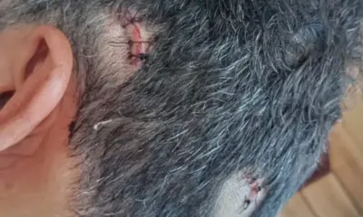 Frame-240-2024-04-10T122322.776-976×600 Empresário é agredido ao ter casa invadida por assaltantes em Cruzeiro do Sul