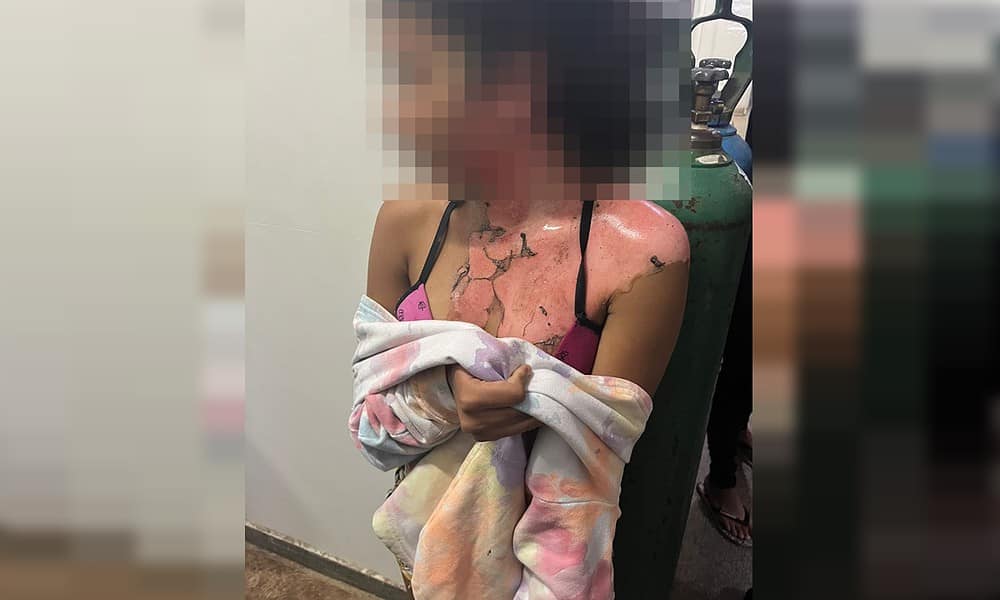 Tia-queima-sobrinha-sobrinha-de-13-anos-com-agua-quente-1 Tia-queima-sobrinha-sobrinha-de-13-anos-com-agua-quente-1