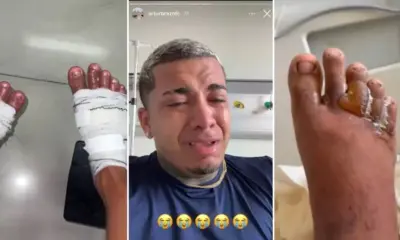 Video-influencers-quase-amputam-pes-apos-queimadur0126523000202404080858-ScaleDownProportional Video-influencers-quase-amputam-pes-apos-queimadur0126523000202404080858-ScaleDownProportional