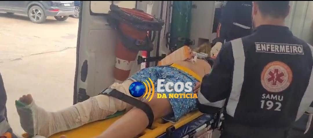 Colisão entre moto e caçamba, deixa mulher com fraturas