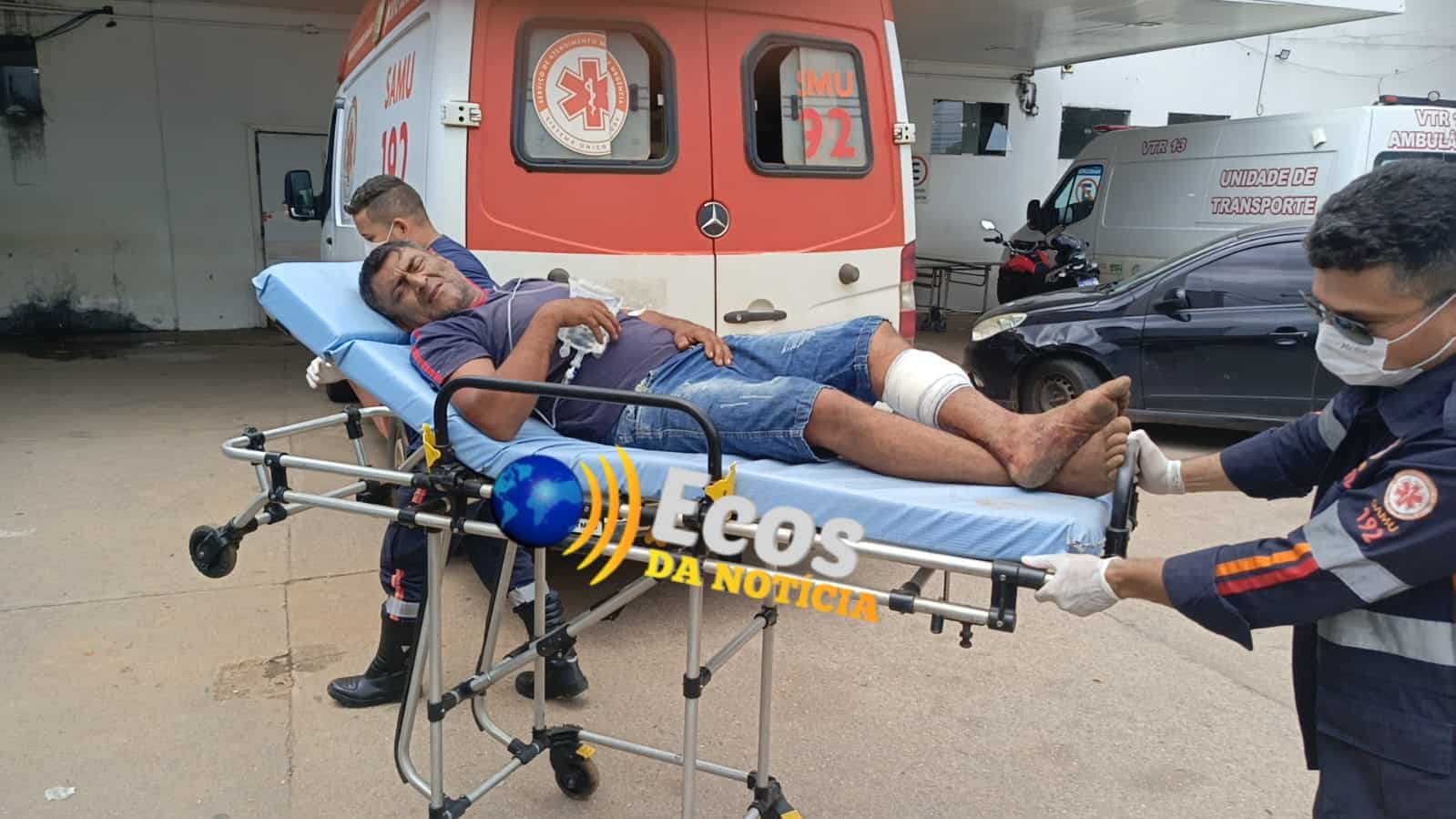 Trabalhador quase tem perna decepada por motosserra