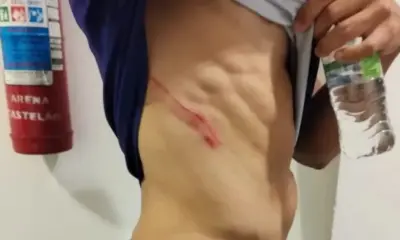 ceara-fortaleza-briga-e1712668943820 ceara-fortaleza-briga-e1712668943820