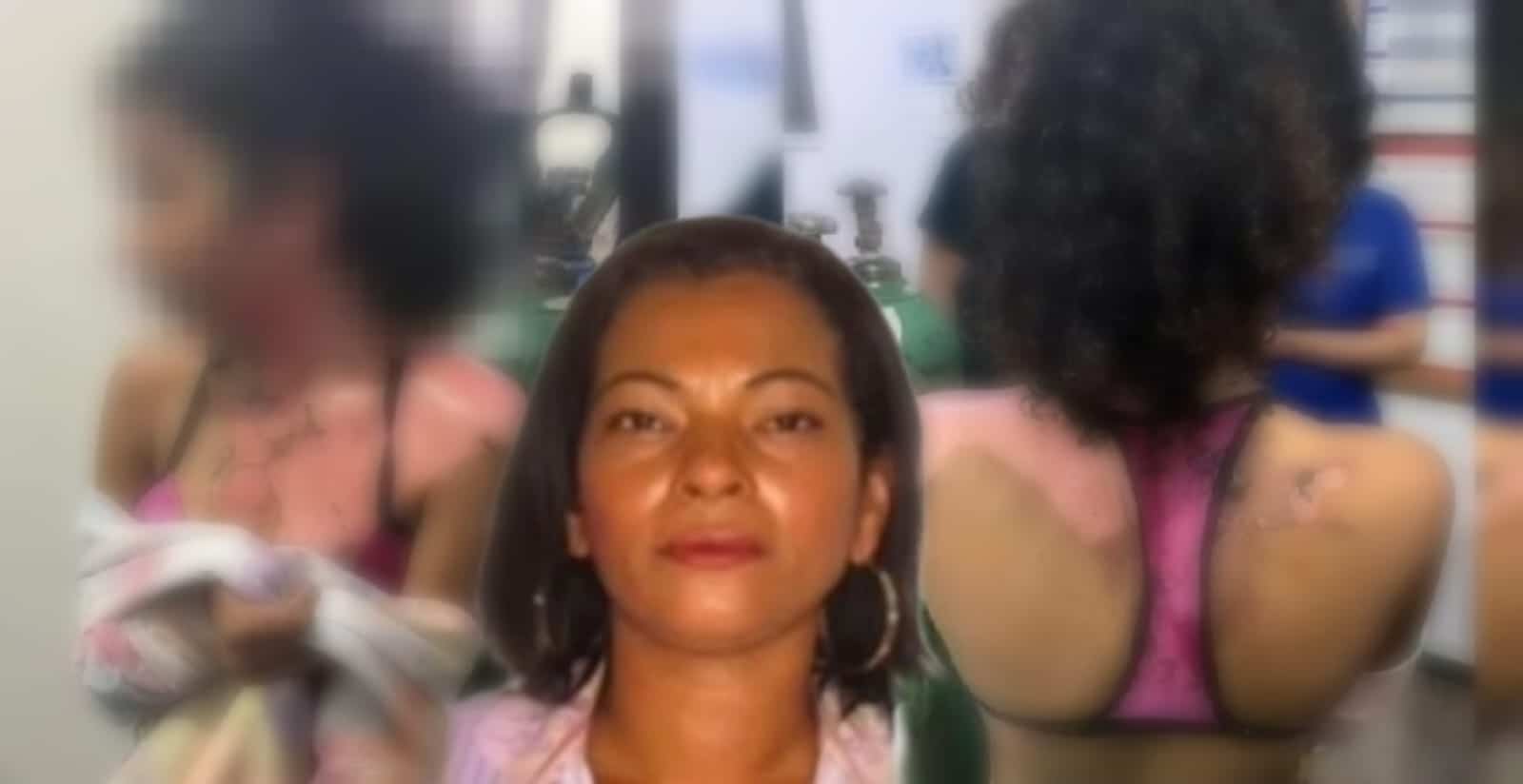 Tia que jogou panela de água quente sobre a cabeça de sobrinha adolescente é presa