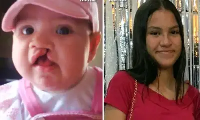 menina labio 996×600 menina labio 996x600