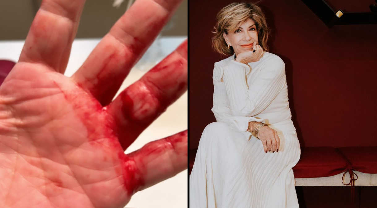 “Quase arrancaram minhas mãos”, conta apresentadora Silvia Poppovic após assalto