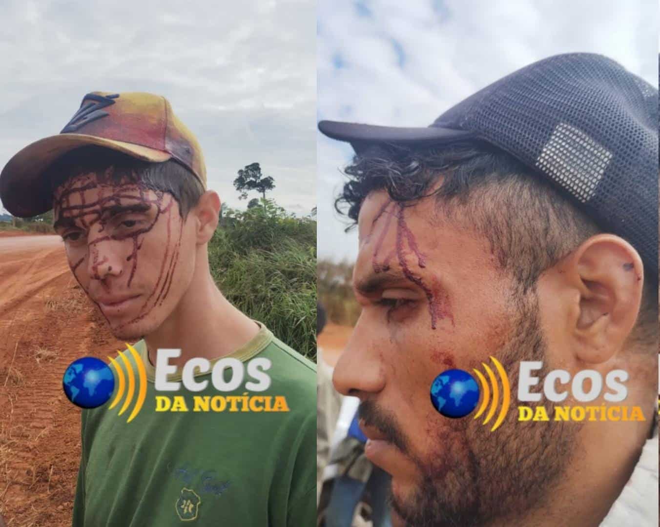 Conflitos por disputa de terra deixa feridos na BR-317; dois dão entrada no Pronto-Socorro de Rio Branco
