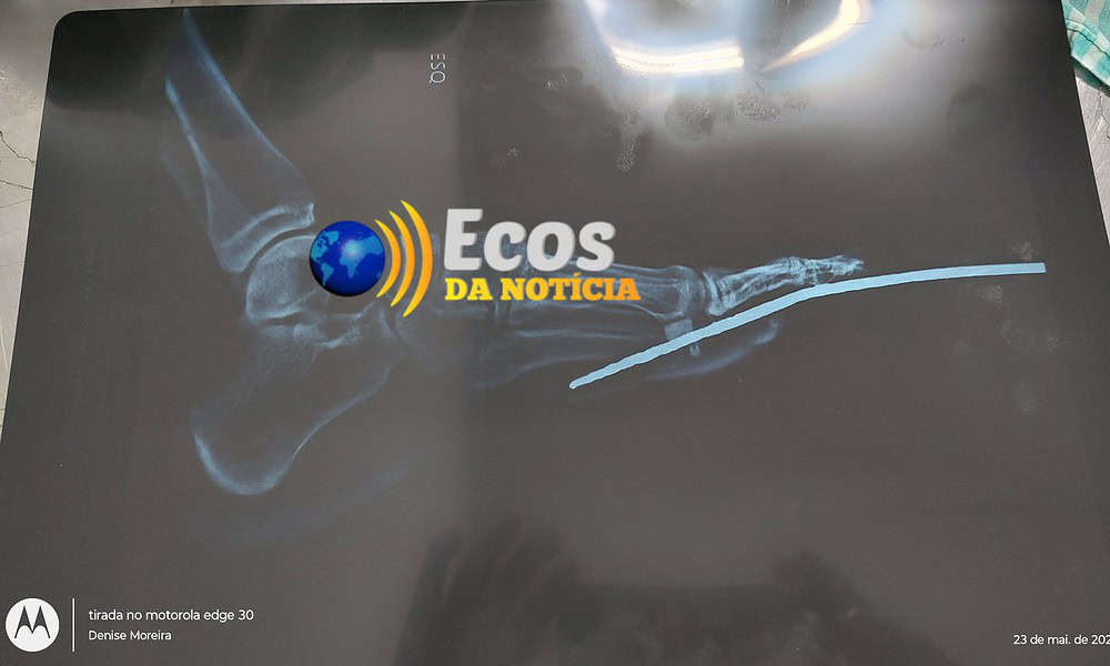 whatsapp image 2024 05 24 at 03.10.13 (1) whatsapp image 2024 05 24 at 03.10.13 (1)