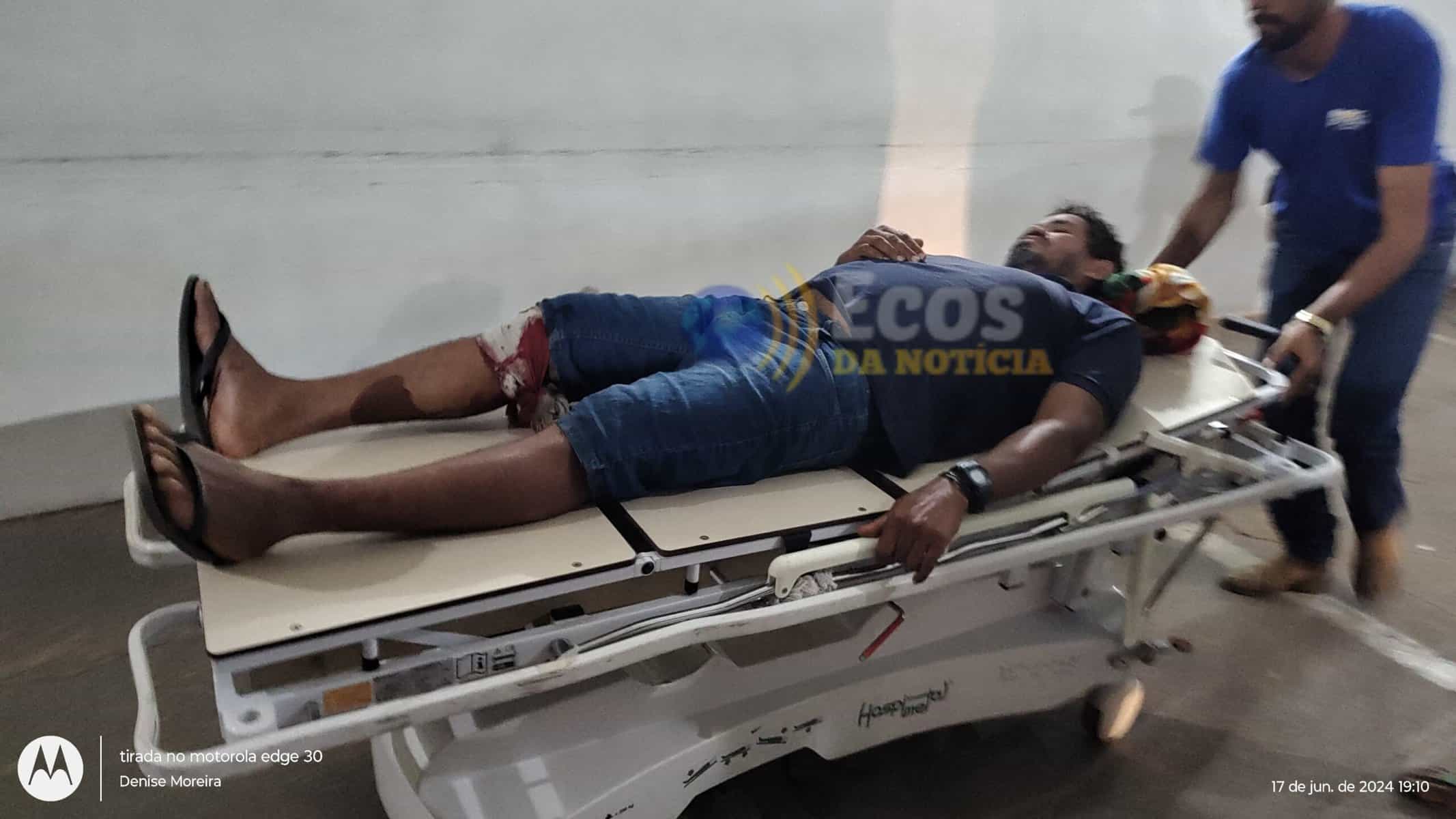 Trabalhador fica ferido após rifle cair e atingir acidentalmente sua perna