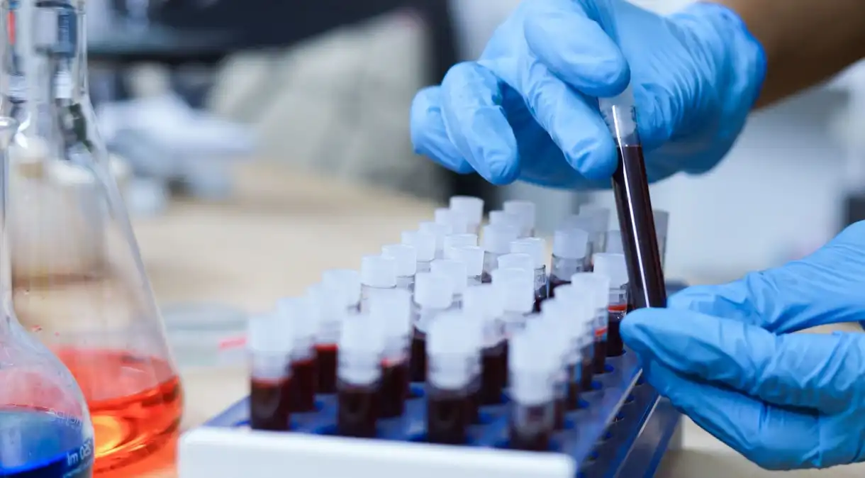 Exame de sangue pode detectar 90% dos casos de Alzheimer, diz estudo