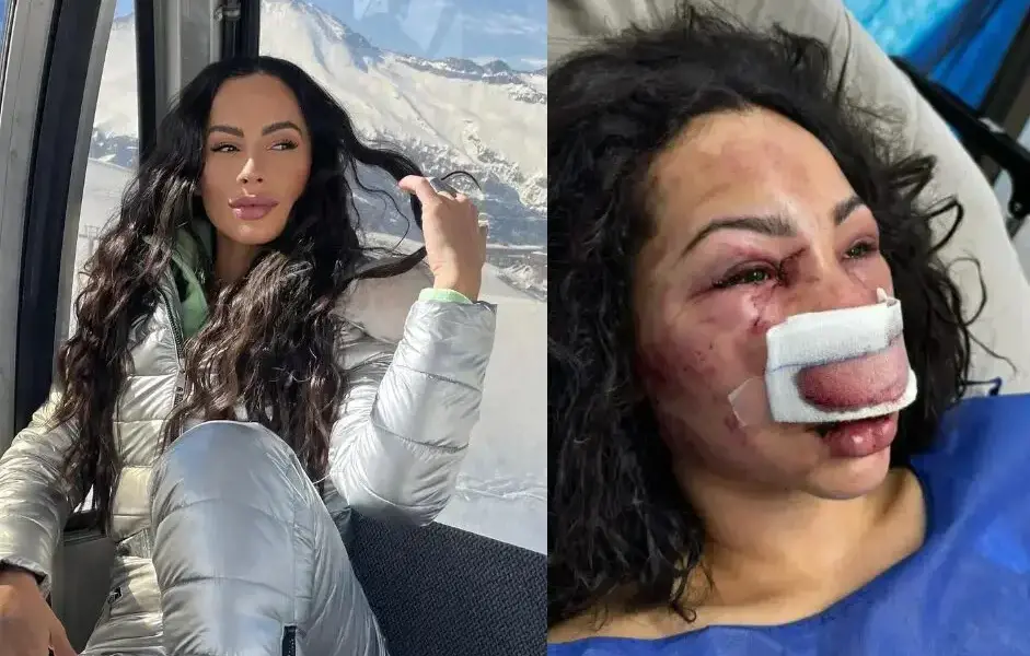 paranaense espancada no chile.jpeg