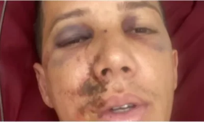 arbitro agredido mg arbitro agredido mg