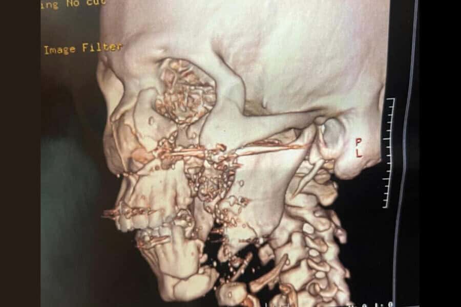 frame 431 2024 08 19t114009.277 900×641 frame 431 2024 08 19t114009.277 900x641