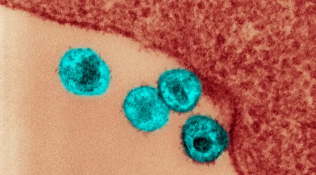 hiv