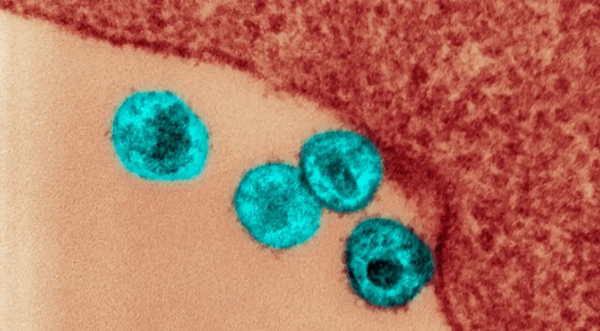 Nova variante do HIV está circulando em três estados do Brasil, diz estudo