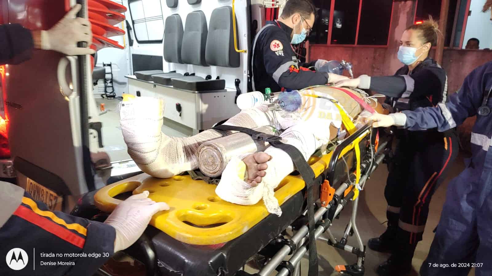 Moradora de rua é atropelada ao tentar atravessar BR-364