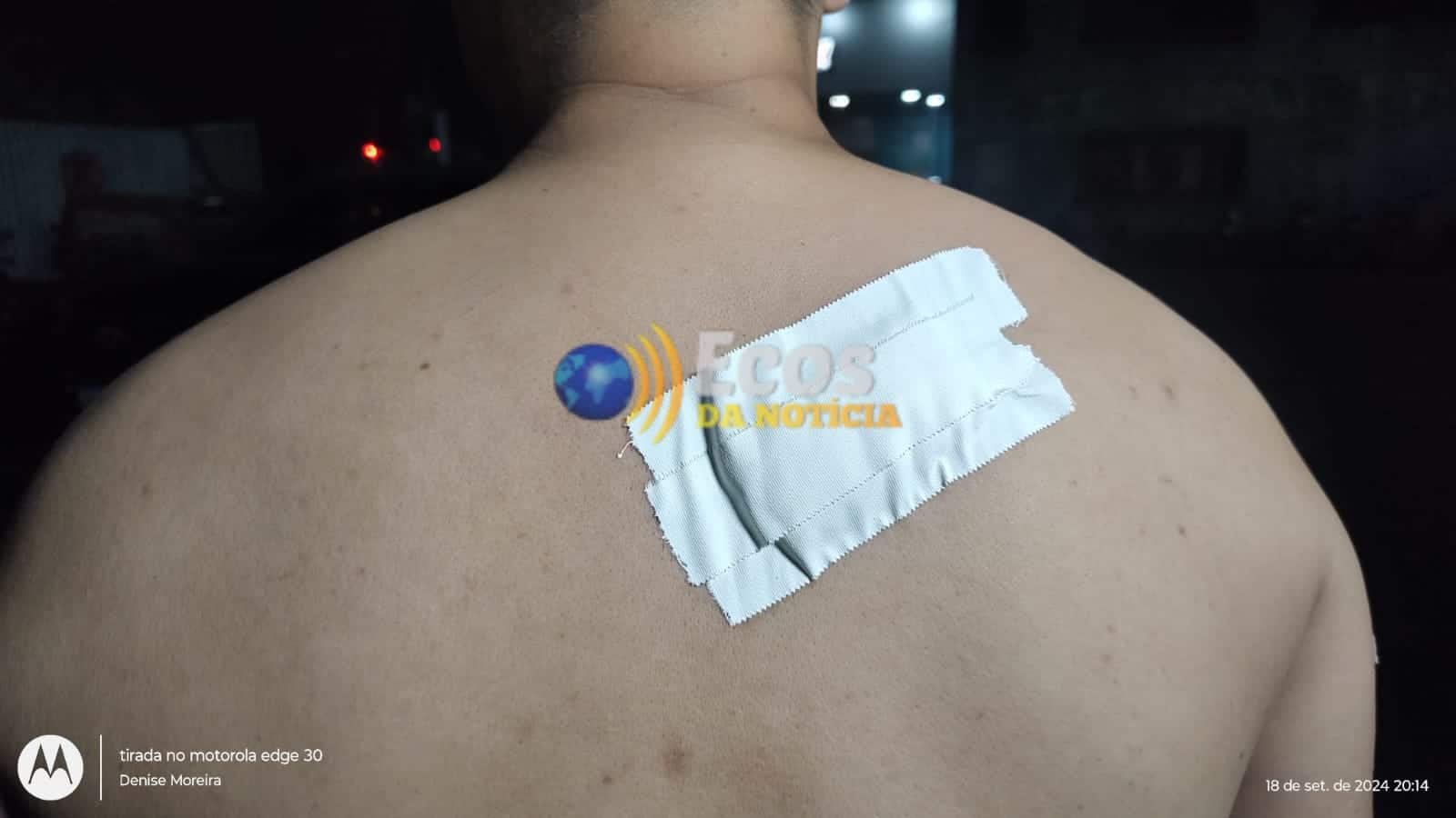 Homem é ferido com golpe de faca durante assalto em Rio Branco