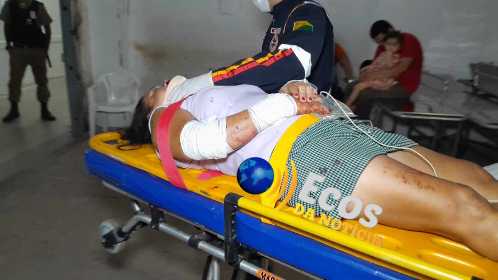 Colisão entre carro e moto deixa mulher ferida no Segundo Distrito de Rio Branco; motorista foge do local