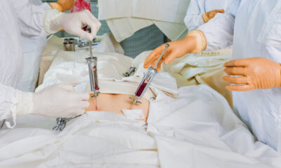 doacao_de_medula_ossea