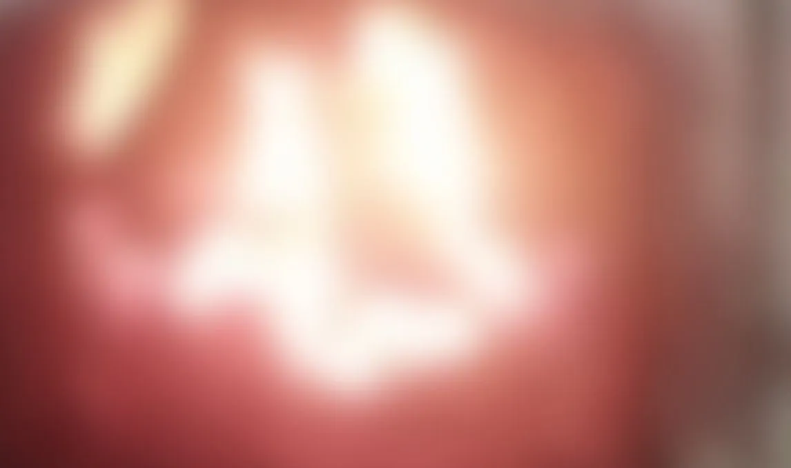 Adolescente queima 5 cães em fornalha e manda vídeo de animais gritando para amigos