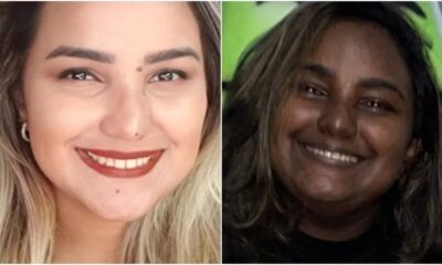 Sabrina Gomes tem doença rara que, entre outros sintomas, alterou a tonalidade de sua pele — Foto: Reprodução